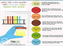 Nước Tiểu Có Chất Hoá Học Gì